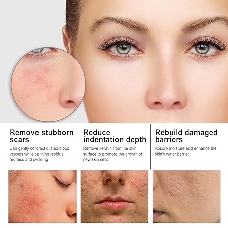 Sérum Facial Antimanchas con Nicotinamida — Tono Uniforme y Piel Luminosa