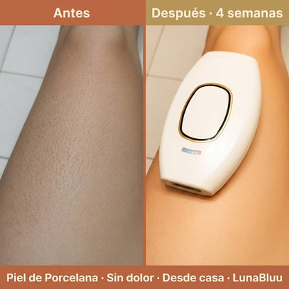Depiladora láser